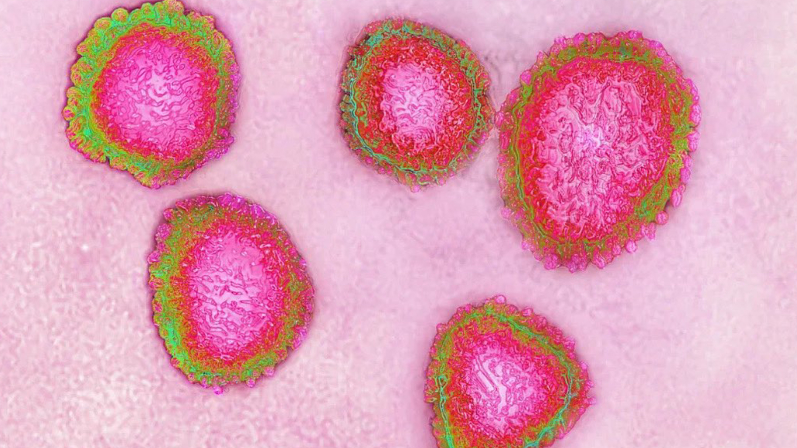 prof dr ceyhan uyariyor covid azalma noktasinda degil her yil artiyor turkiyede asisi yok 8Fq8xRmx